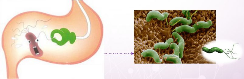全国无幽日——幽门螺杆菌全科普
