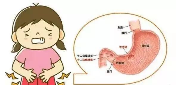 胃溃疡离胃癌到底有多远？5大信号需警惕