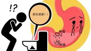 胃溃疡离胃癌到底有多远？5大信号需警惕