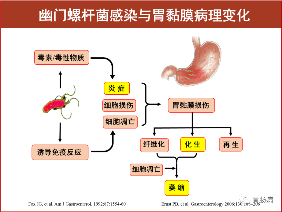 幽门螺杆菌的八个认识