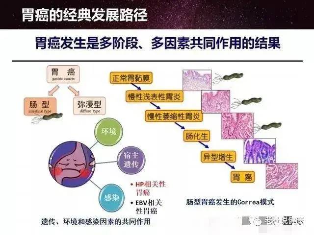 浅表性胃炎，需要治疗吗？