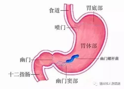 带您了解“消化系统疾病帮凶—幽门螺旋杆菌”防治知识