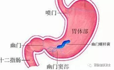 关于反流性胃炎，你必须知道这几点！