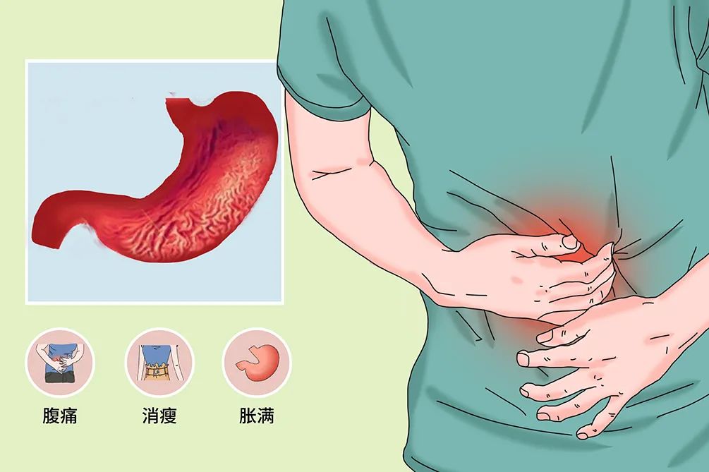 关于萎缩性胃炎六大事实，看完就明白了