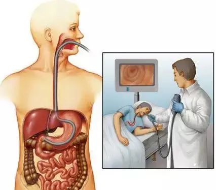 一步到“胃”的胃镜检查会伤身体吗？