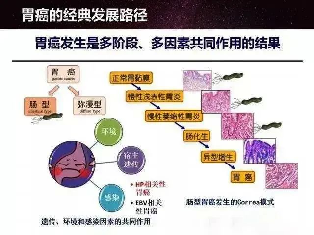 慢性萎缩性胃炎离癌变有多远？