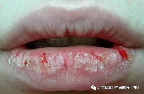 身体好不好，脾胃说了算!2招帮你调理脾胃