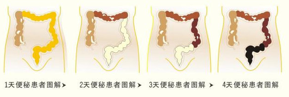 经常便秘怎么办？5个小方法，帮助你润肠通便！