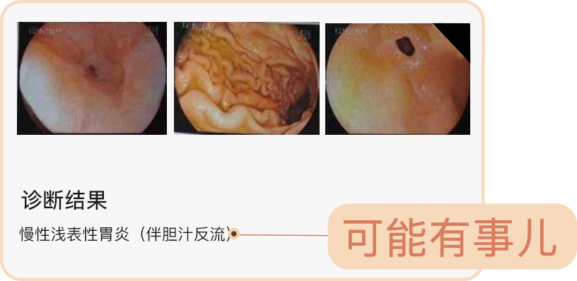 今日科普 |3分钟，教你看懂胃镜报告！！