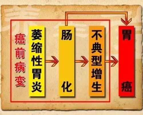 饭后腹胀、癌前病变？慢性萎缩性胃炎真的那么可怕吗？