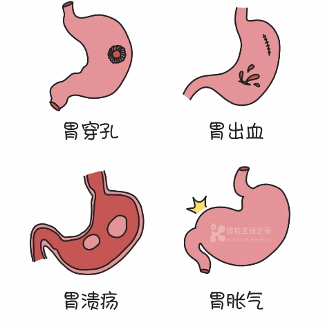 其实，90%的胃癌都是可以治愈的。