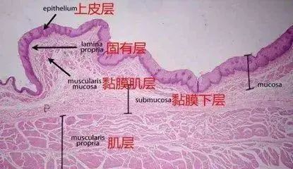 胃痛都是病，你知道自己属于哪种胃病吗？