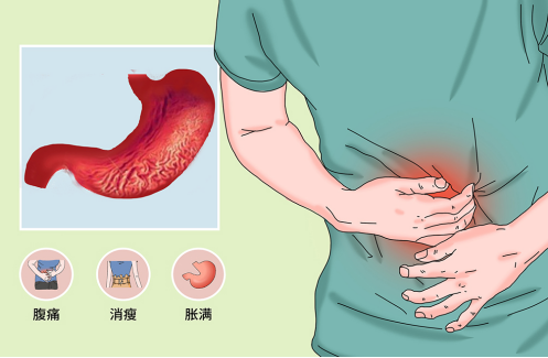 一吃饭就消化不良，是咋回事儿?