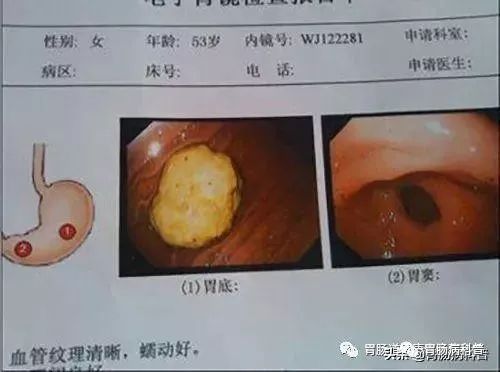 入秋了，柿子好吃可不要贪嘴哦