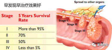 健康的生活方式能够预防结直肠肿瘤