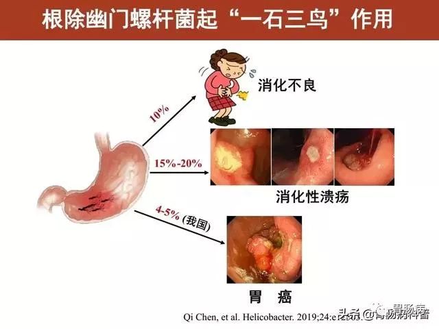 在浅表性胃炎阶段，根除幽门螺杆菌，几乎可100%预防肠型胃癌