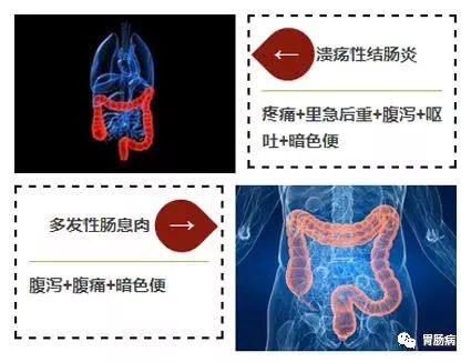 大便带血要小心！这种情况，可能是癌！