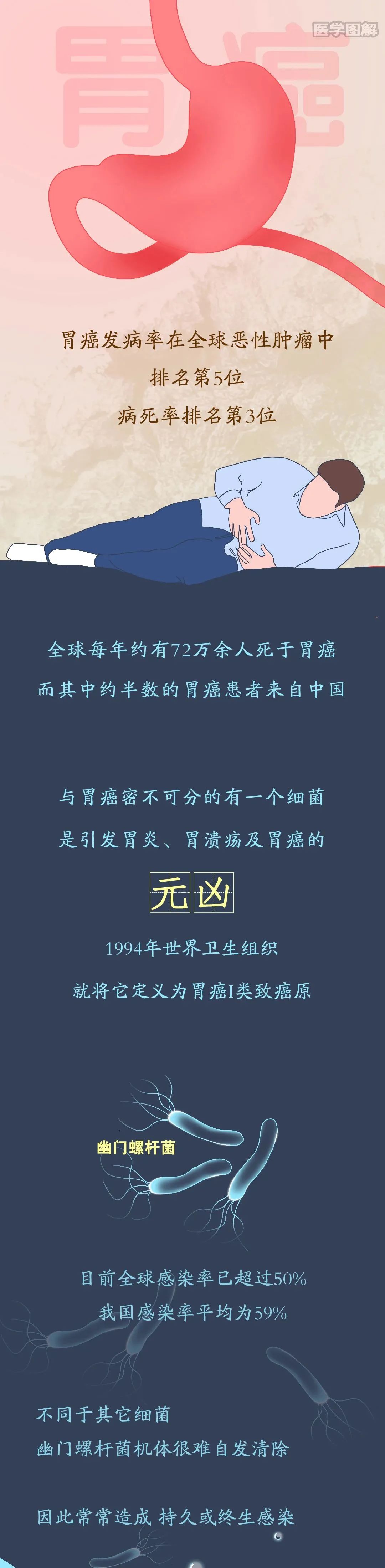 科普丨胃癌早期大多没有信号，如何远离胃癌？