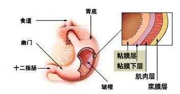 浅表性胃炎，还需要治疗吗？