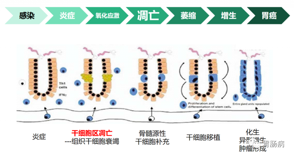 萎缩性胃炎，是胃缩小了么？一定会癌变吗？能治好吗？