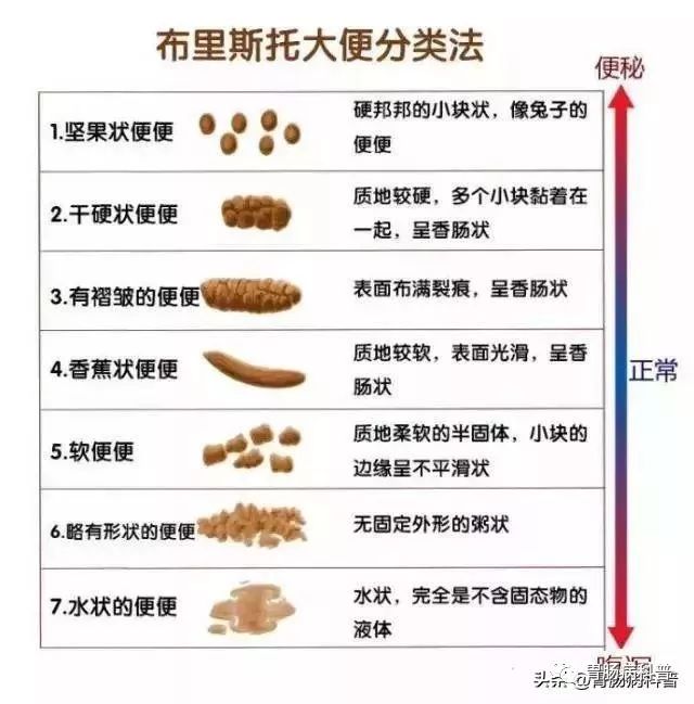 大便变细就是得了肠癌？医生说：不一定，还有这些可能