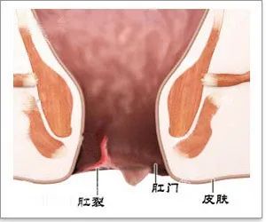 疼痛性便血与无痛性便血的区别有哪些？