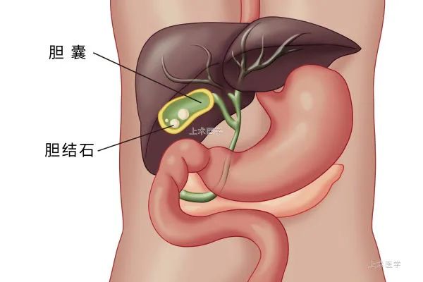 长期不吃早饭容易饿出这7种病！这有什么科学依据？