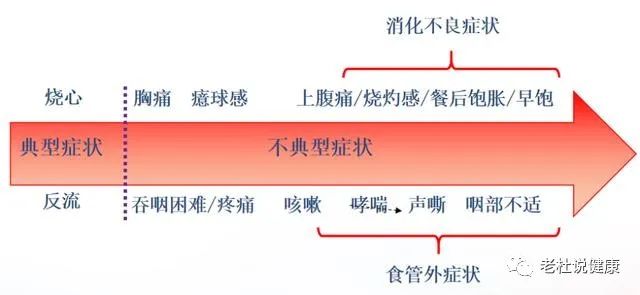 别把“烧心”不当病，发作起来能要命——谈谈胃食管反流症