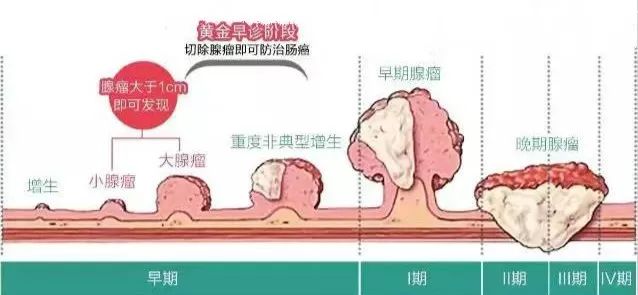 为啥会长胃肠息肉？都有啥危害？怎么预防和治疗？