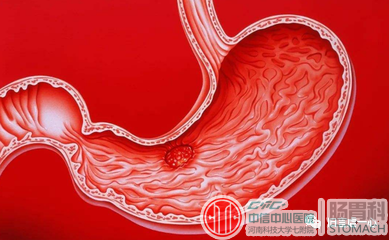 若想肠胃健康，少吃3种肉，谨记“一慢一喝一暖”，效果明显