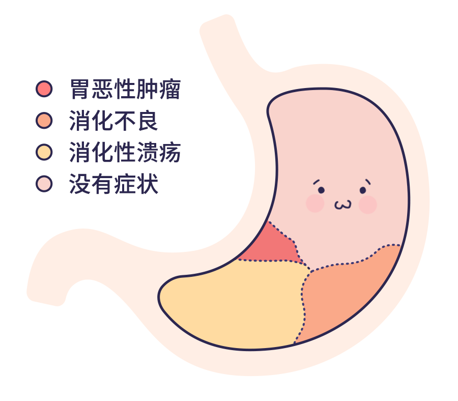 幽门螺杆菌的自白：感染了 8 亿中国人，我是你最该了解的细菌！