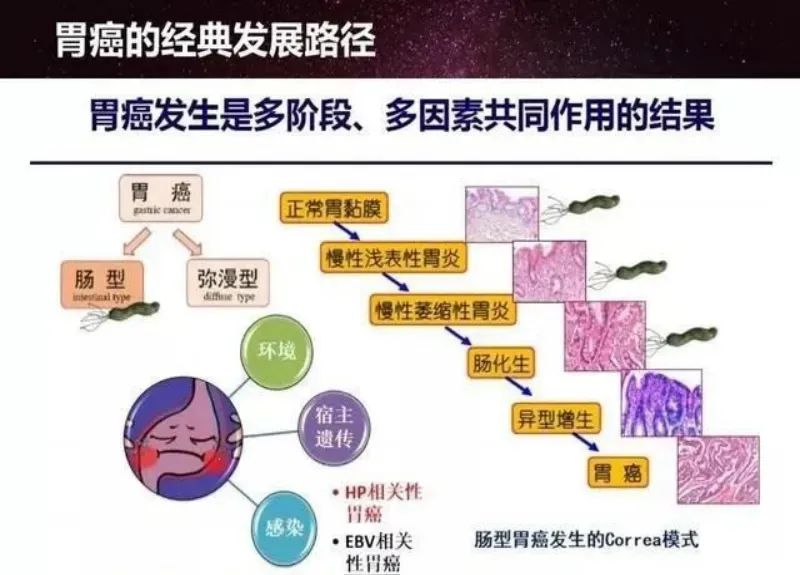 痛惜！90后舞蹈家因胃癌离世，从确诊到离开只有8个月！