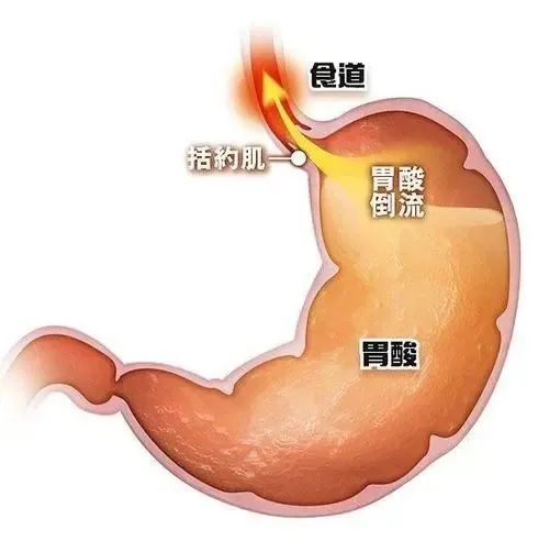 痛惜！90后舞蹈家因胃癌离世，从确诊到离开只有8个月！