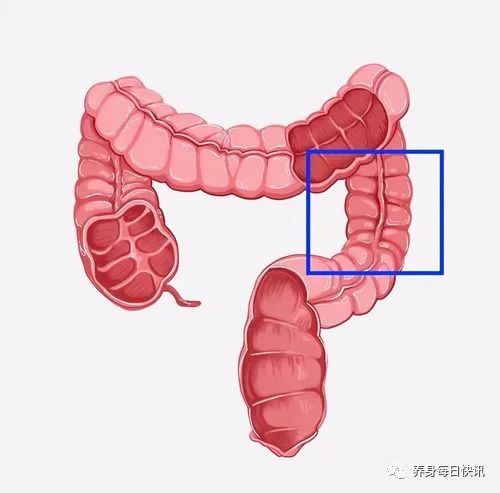 直肠癌是拖出来的？直肠癌早期有哪些表现？这4个比较明显