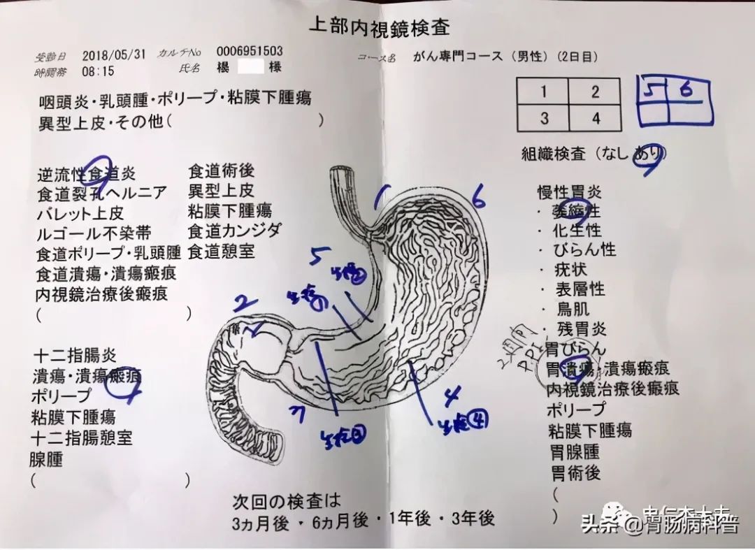 预防胃癌，我们应该怎么做？