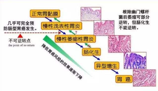 浅表性胃炎严重吗？怎么治疗？一篇文章告诉你