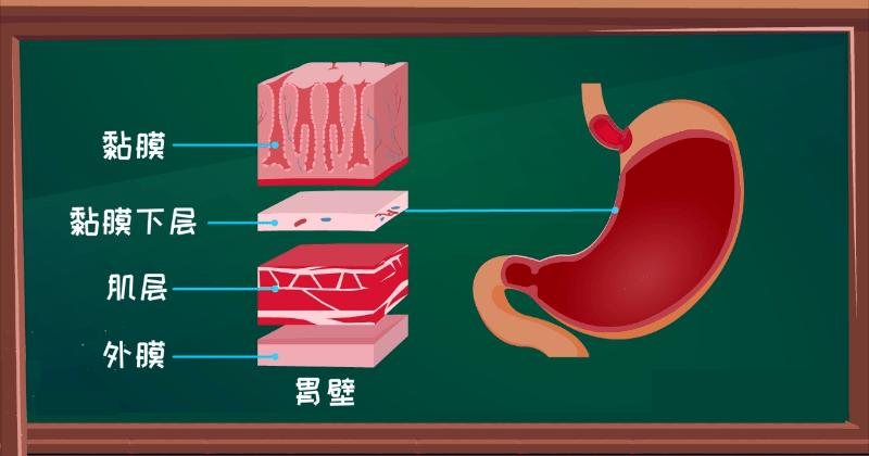 为什么会得胃溃疡?