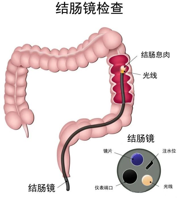 年终岁尾，需要给“胃肠”做一做检查！