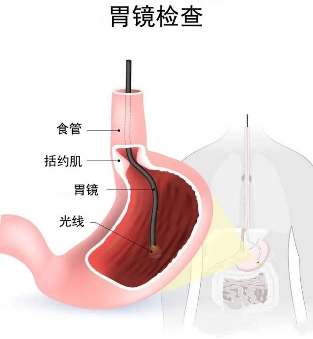 年终岁尾，需要给“胃肠”做一做检查！