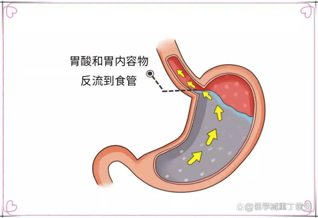 保养肠胃，在日常生活中需要注意哪些呢？