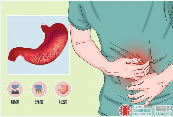 慢性萎缩性胃炎该调养方法大全