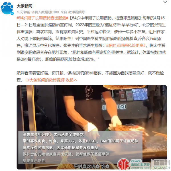 男子长期便秘，结果查出肠癌！便秘"最爱"这些习惯，希望你一个都不占…